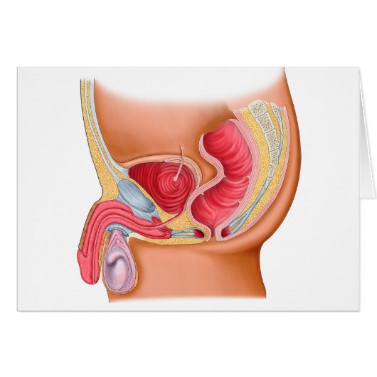 Medical Illustration Of A Rectourethral Fistula Cards (Front Horizontal)