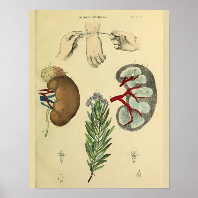 Medical Wrist Surgery Kidneys Anatomy Art Print (Front)