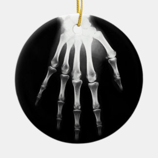 Medical X-Ray Doctor Hospital X-Ray Hand Ceramic Ornament