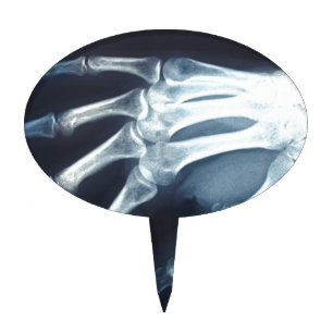 Medical X Ray Imaging Hand Fingers Cake Topper