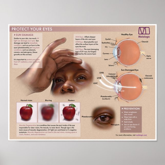 Melalogic Eye Protection Medical Poster (Front)