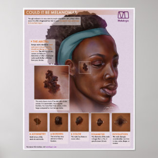 Melalogic Melanoma Medical Poster