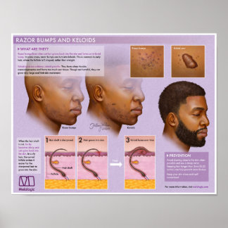 Melalogic Razor Bumps and Keloids Medical Poster