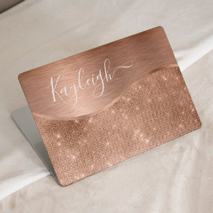 Metallic Rose Gold Glitter Personalized HP Laptop Skin
