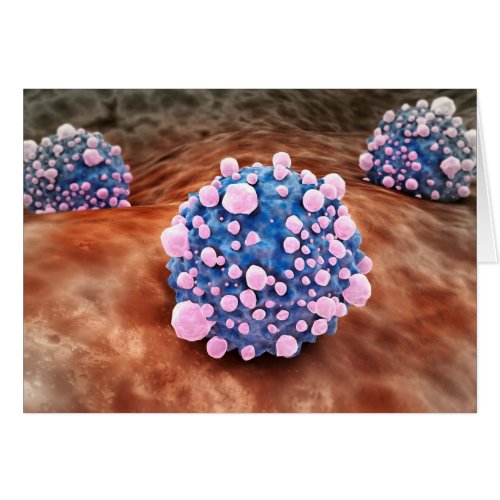 Microscipic View Of Pancreatic Cancer Cells 2