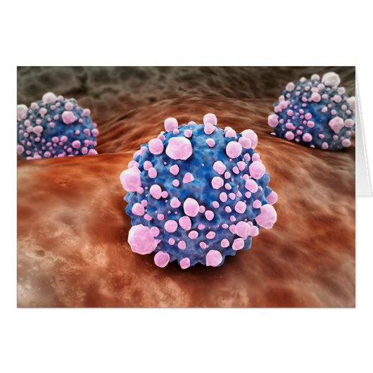 Microscipic View Of Pancreatic Cancer Cells 2 (Front Horizontal)