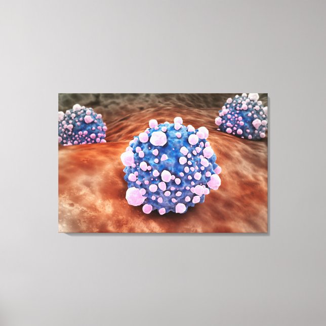 Microscipic View Of Pancreatic Cancer Cells 2 Canvas Print (Front)