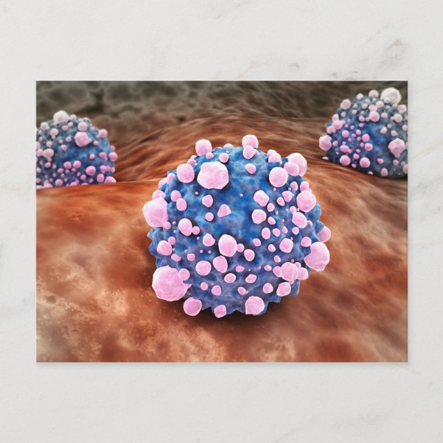 Microscipic View Of Pancreatic Cancer Cells 2 Postcard (Front)
