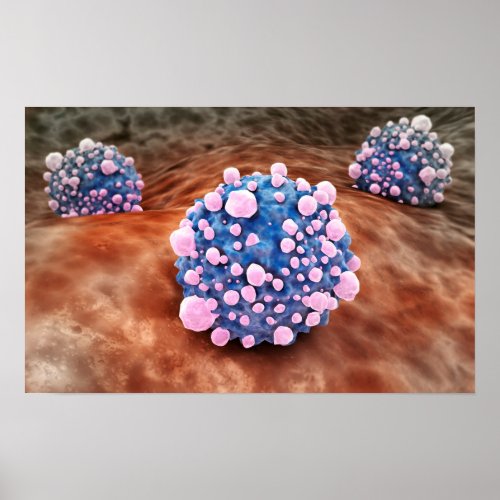 Microscipic View Of Pancreatic Cancer Cells 2 Poster