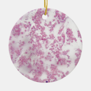 Microscope photo of human blood with Trypanosoma b Ceramic Ornament