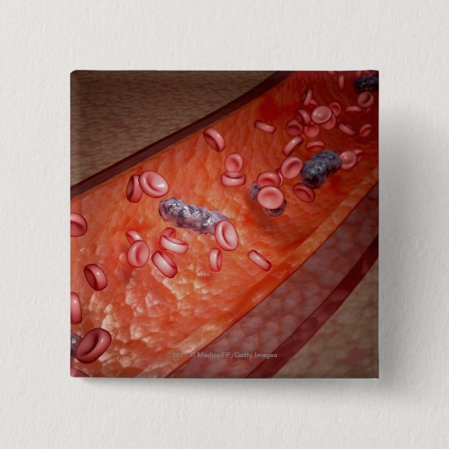 Microscopic rendering of a blood infection button (Front)
