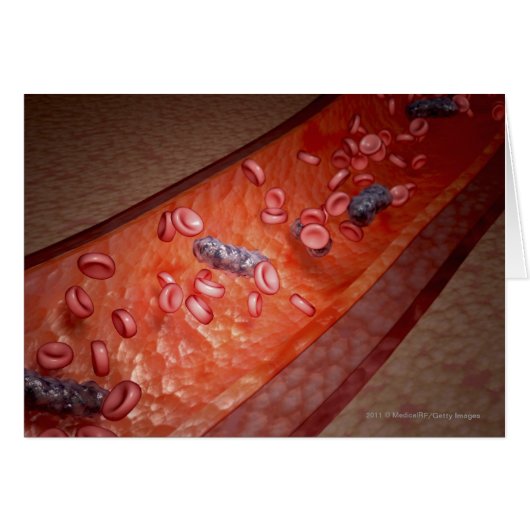 Microscopic rendering of a blood infection cards (Front Horizontal)