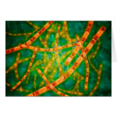 Microscopic View Of Anthrax 2 (Front Horizontal)