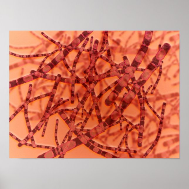 Microscopic View Of Anthrax 3 Poster (Front)