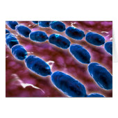 Microscopic View Of Bacterial Pneumonia 1 (Front Horizontal)