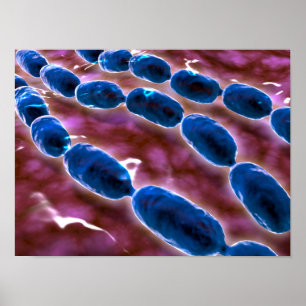 Microscopic View Of Bacterial Pneumonia 1 Poster