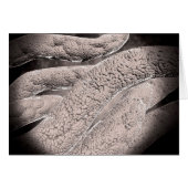 Microscopic View Of Corncob Formation (Front Horizontal)