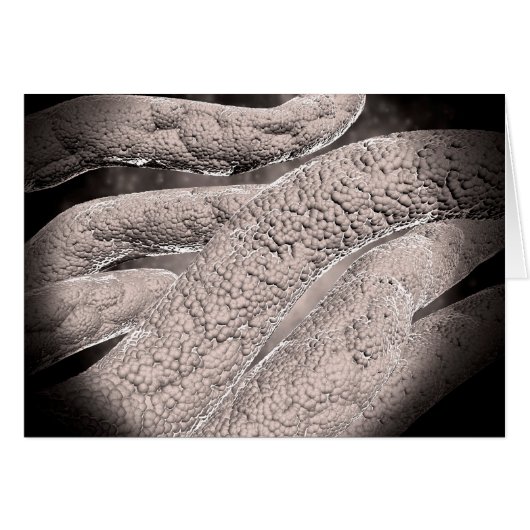 Microscopic View Of Corncob Formation Cards (Front Horizontal)