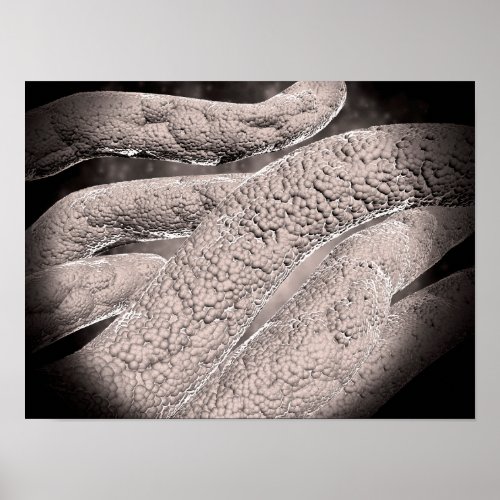 Microscopic View Of Corncob Formation Poster
