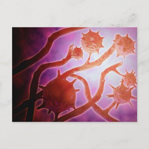 Microscopic View Of Histoplasmosis Postcard