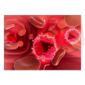 Microscopic View Of HIV Virus Inside The Lungs (Front Horizontal)