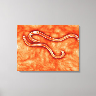 Microscopic View Of Hookworm 2 Canvas Print