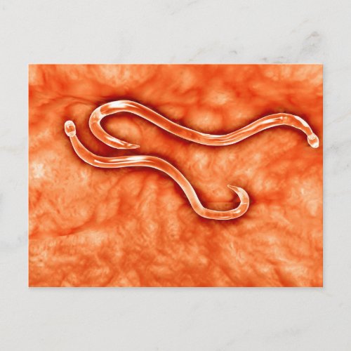 Microscopic View Of Hookworm 2 Postcard