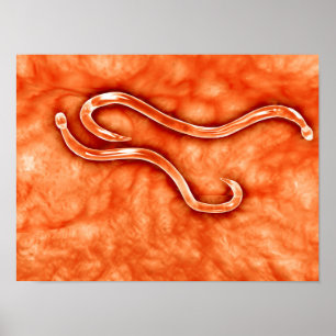 Microscopic View Of Hookworm 2 Poster