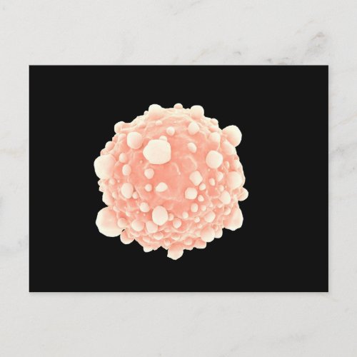 Microscopic View Of Pancreatic Cancer Cell Postcard