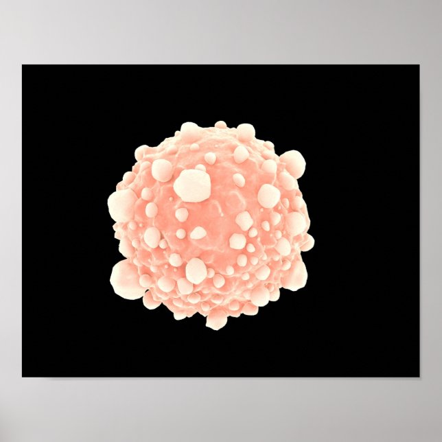 Microscopic View Of Pancreatic Cancer Cell Poster (Front)