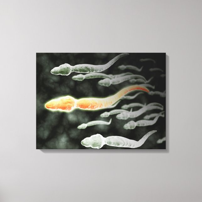 Microscopic View Of Sperm Traveling Canvas Print (Front)