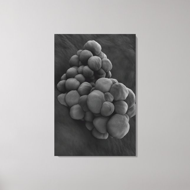 Microscopic View Of Tumor 1 Canvas Print (Front)