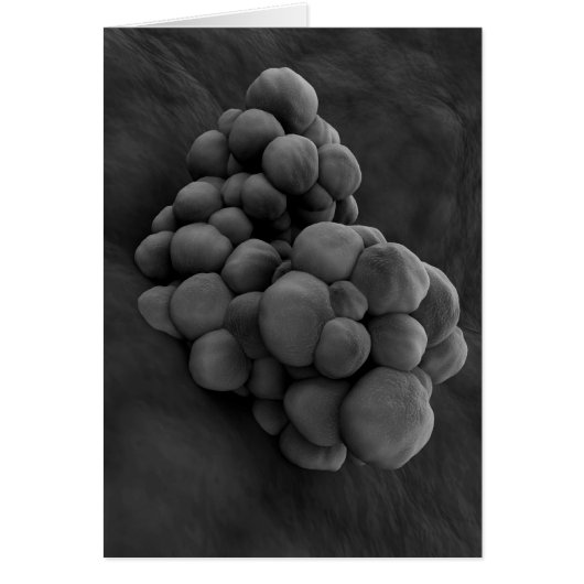Microscopic View Of Tumor 1 Cards (Front)