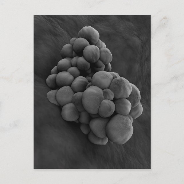 Microscopic View Of Tumor 1 Postcard (Front)