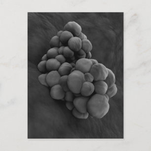Microscopic View Of Tumor 1 Postcard