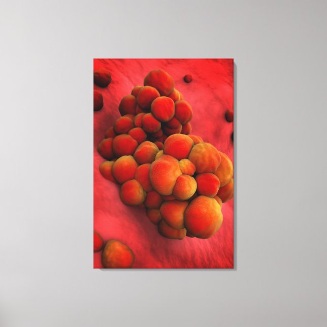 Microscopic View Of Tumor 2 Canvas Print (Front)