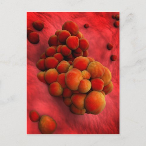 Microscopic View Of Tumor 2 Postcard
