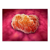 Microscopic View Of Tumor 3 (Front Horizontal)