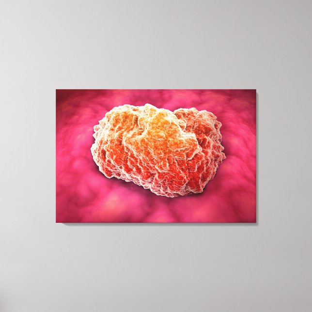 Microscopic View Of Tumor 3 Canvas Print (Front)