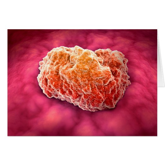 Microscopic View Of Tumor 3 Cards (Front Horizontal)