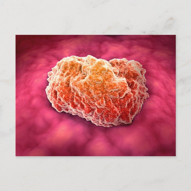 Microscopic View Of Tumor 3 Postcard (Front)