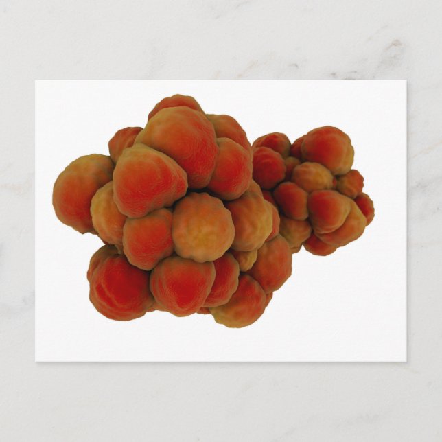 Microscopic View Of Tumor 4 Postcard (Front)