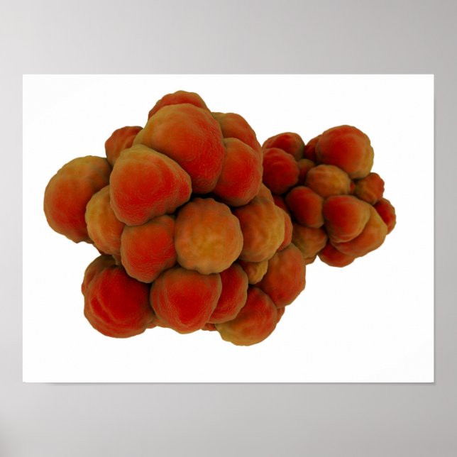 Microscopic View Of Tumor 4 Poster (Front)