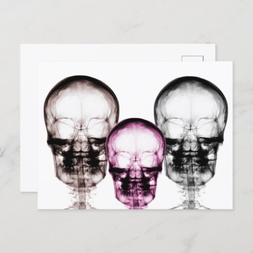 Mixed Color X_Ray Vision Skeletons Skulls Postcard