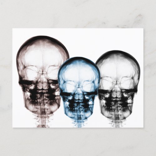 Mixed Colors X_Ray Vision Skeleton Skulls Postcard