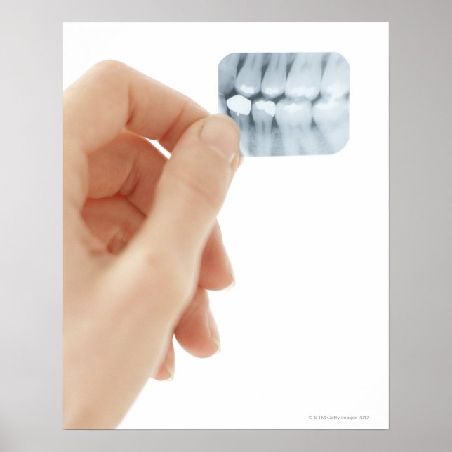 MODEL RELEASED. Dental X-ray. Poster (Front)