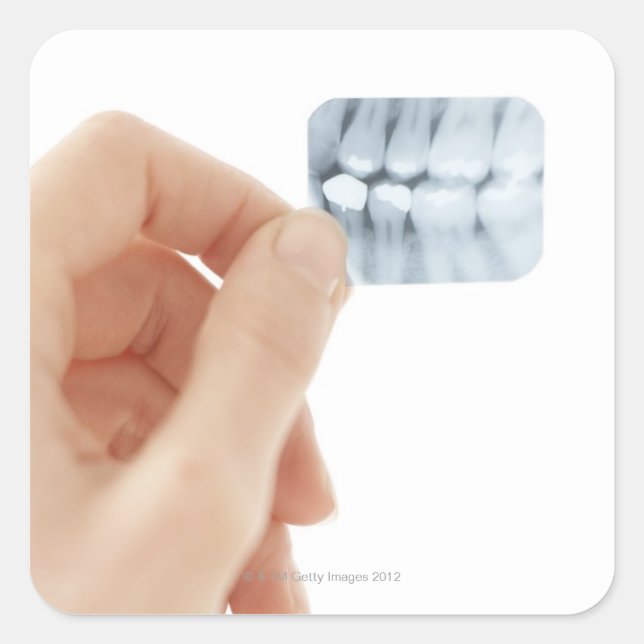 MODEL RELEASED. Dental X-ray. Square Sticker (Front)