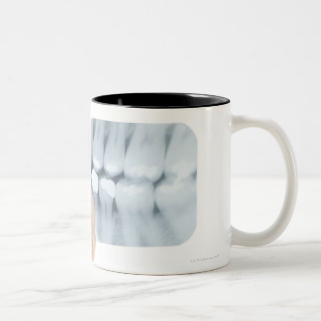 MODEL RELEASED. Dental X-ray. Two-Tone Coffee Mug (Right)
