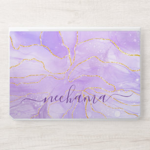 Modern Elegant Glitter Monogram HP Laptop Skin