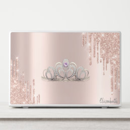 Modern Glitter Drips Rose Gold Tiara HP Laptop Skin